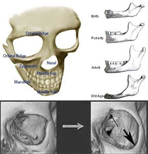 Facial Bone Loss FlexEffect Facialbuilding